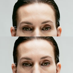 Targeted Skin-Tightening Concentrate — 10% Inhibiting Peptide Complex + Hyaluronic Acid 0.50 floz